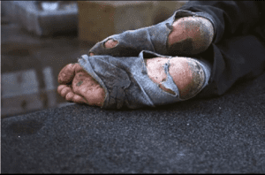 Homeless Feet